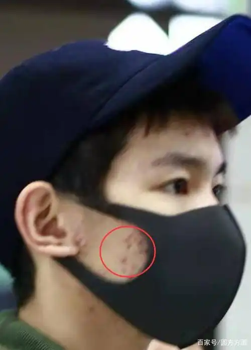 王源大主宰怼脸照火了!镜头拉近后,你男神的脸可能还不如你!