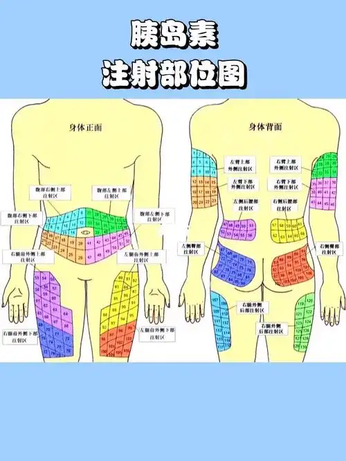 yds的注入部位图