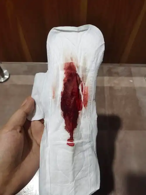 [试管婴儿]今天早晨九点出血,鲜红的血,月