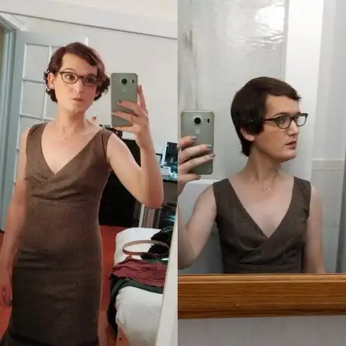 亮瞎眼!男子服用雌激素一年 抠脚大汉变娇娘