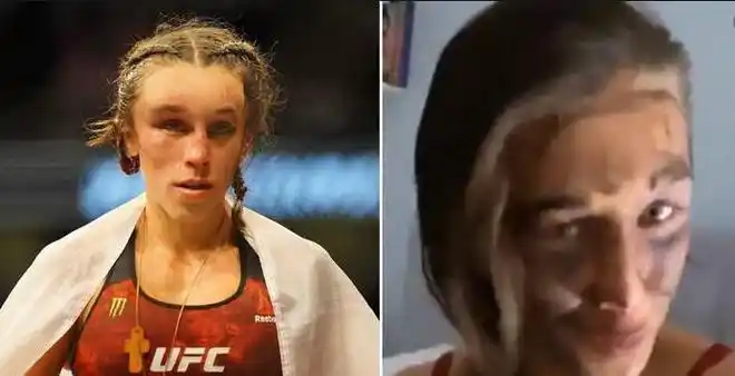 ufc248乔安娜被张伟丽打服表示不会开病人玩笑愿张伟丽保重