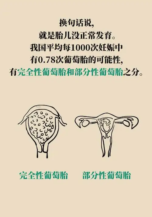 怀孕发现是葡萄胎,到底是什么情况?--科普中国--人民网