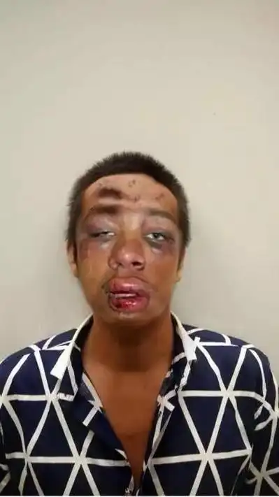 ps恶搞:求大神p成被打后的样子,结果这哥们被p成鼻青脸肿!