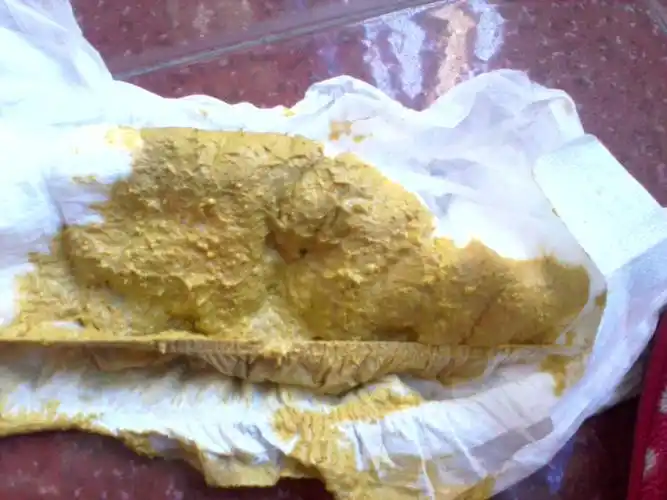 宝宝三个月多一点 人工喂养 前些天有点消化不良 便便有点黄绿色 奶瓣