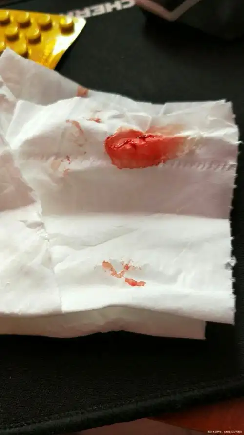 怀孕11周昨天下午上街热了吊了两天吊针刚才咳出血