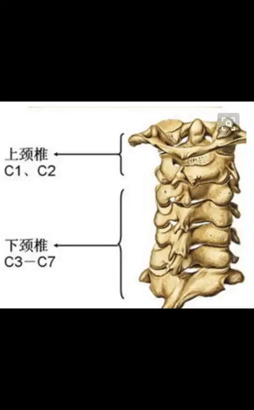 颈动脉窦位于颈6横突后方,中下段颈椎,颈4～6横突错位时,横突后方肌肉