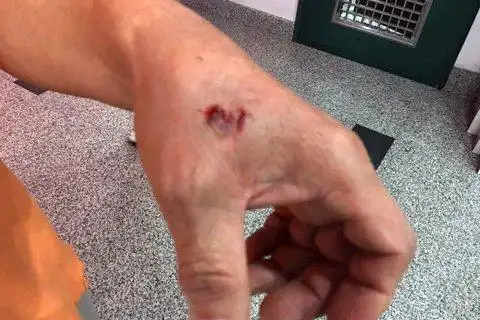 无主狗流窜咬人 警方:持续搜索无主犬只