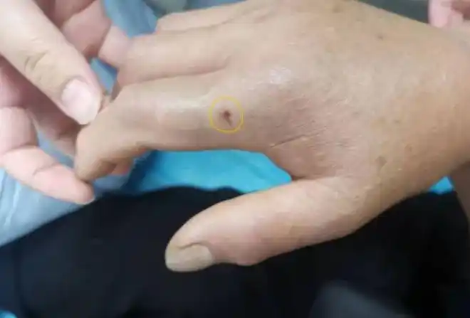 蝮蛇眼镜蛇银环蛇湖南毒蛇咬人事件频发该打死还是放生