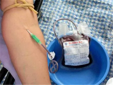 【卖血400毫升多少钱】卖血400cc的价格_亲亲宝贝网