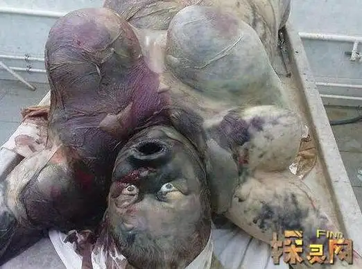 尸体腐烂后就会膨胀巨大化