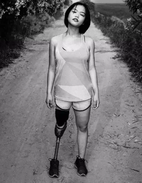 这个独腿女孩穿迷你裙,上联合国开会,何炅被她惹哭?_网易订阅