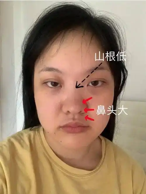 为什么塌鼻子的女生更受男生欢迎