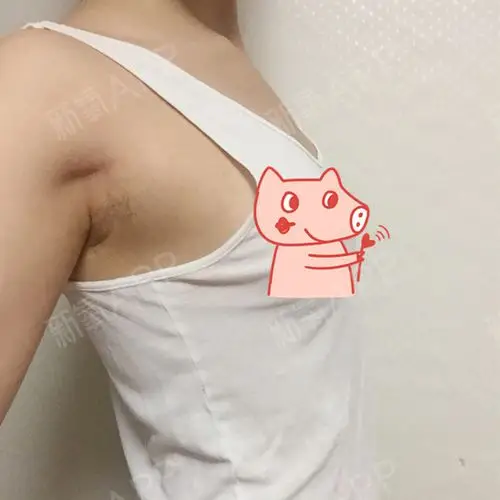 我的身高165 体重49kg 原来胸75a 其实a罩杯带也大.