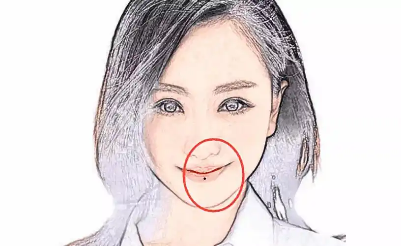 克夫痣,女人脸上五处痣不能留!