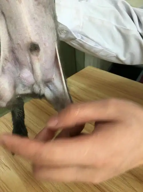 双侧腹股沟疝气,需要手术吗?