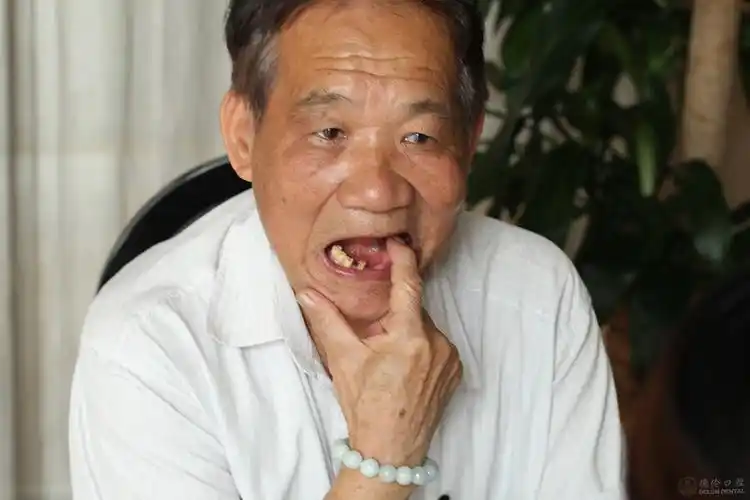 牙齿掉了,如何选择合适的修复方法?