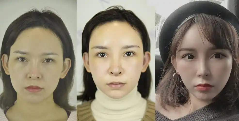 [:14]非主流自拍也挡不住的鼻孔外露 ?[:14_圈子-新氧美容整形