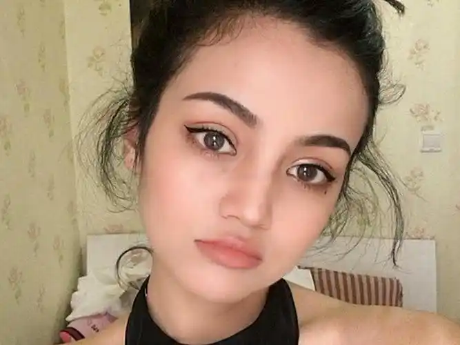 之前做的重睑不满意,觉得太窄了,就重新做了一个,她更喜欢西方欧式款.