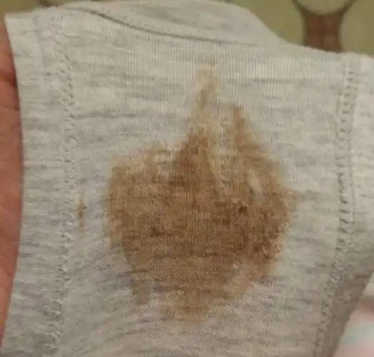 水样液体增多如果到了孕晚期,内裤上有水样泛黄的液体流出,活动时