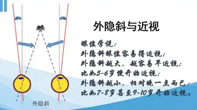 而内隐斜的孩子呢,当你看近的时候,他本身就是内隐斜,人家只需要轻微