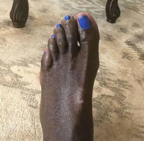 值得一提的是,奥尼尔去年就在tnt晒出自己的脚趾,这引起了球迷的