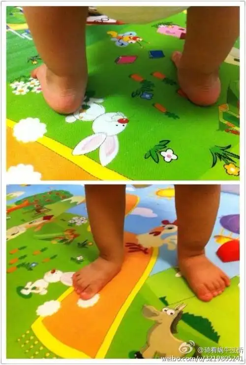 外孙女两周岁多一点,最近发现走路姿势有点不对劲儿,有人说是足外翻