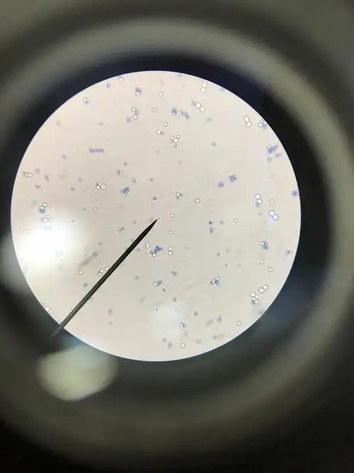 我们小组制作的水浸片-酵母菌的观察,明显观察到死活酵母菌及动态酵母