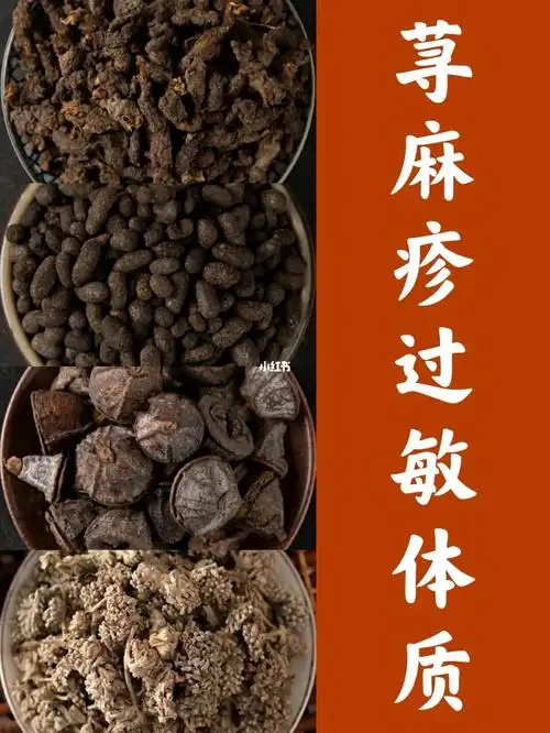 荨麻疹_过敏体质_止痒_皮肤病_医疗健康_医疗健康其他