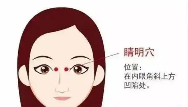【取穴位置】在面部,目内眦角稍上方凹陷处.