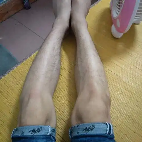 请问这样的腿型是o型腿?要怎样治疗?