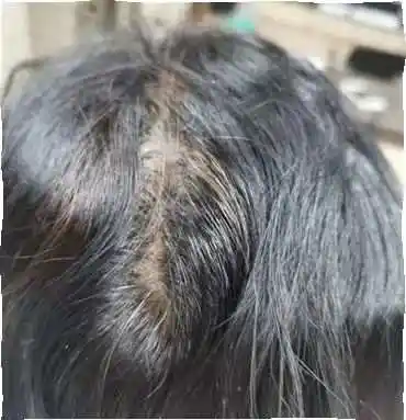 是熬夜太多,精神压力大,便没太在意,买了些说有黑发功能的芝麻丸吃,没