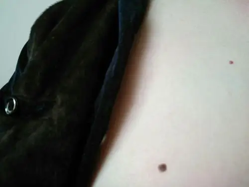 请问朋友们,我这皮肤上是,啥原因呢?