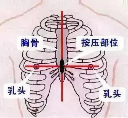 医护人员可能就是按照医科书上的话找位置:"两乳头连线的中点偏下方"