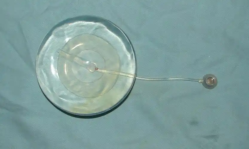 扩张器和皮肤扩张术经典问答 - 好大夫在线