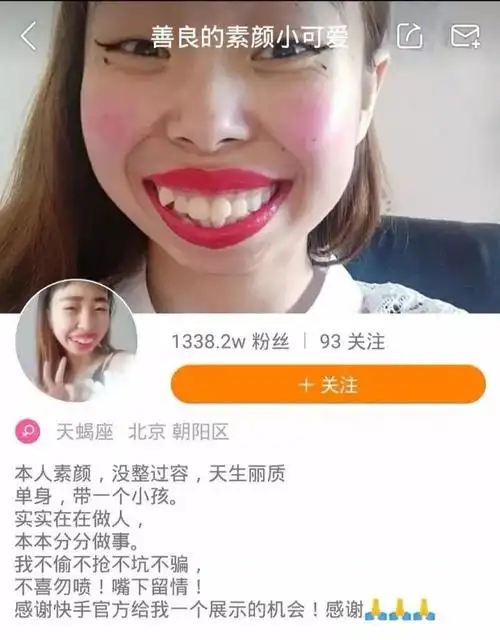 嘟嘟姐被封了,长的与众不同有错吗,你们怎么看?