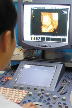 三维彩色b超可以清楚看到胎儿的一举一动.