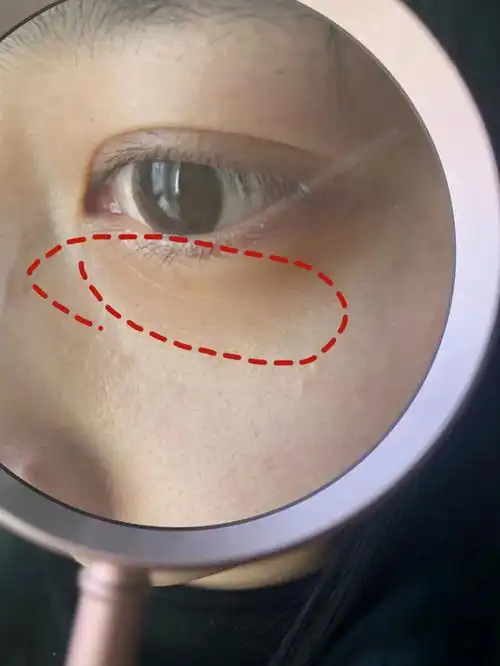 我这是干纹还是细纹啊? - 知乎