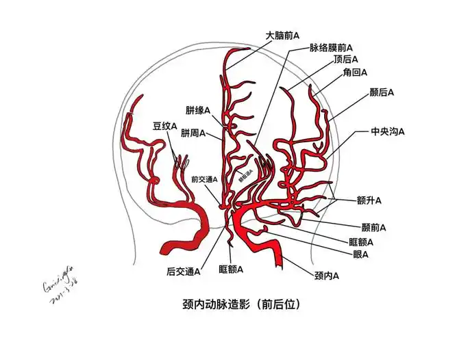 颈内动脉分支,走行|颈内动脉|动脉|分支|走形|大脑|-健康界