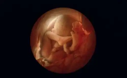 怀孕10周小孩成型图片 10张图胎儿发育成型全过程