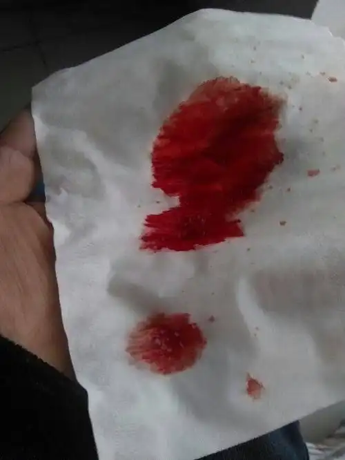 我气得吐血…这是为什么