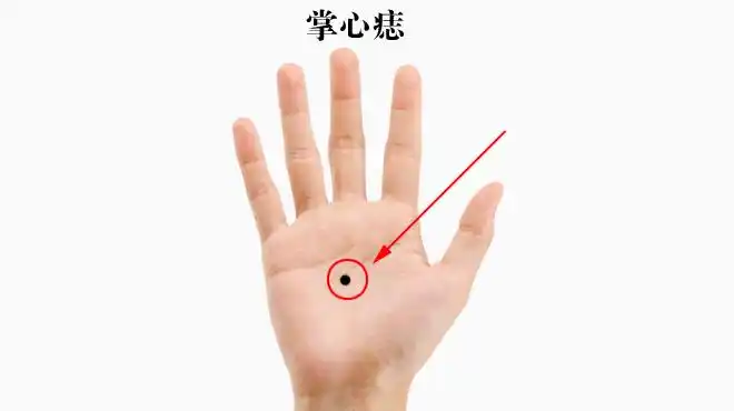 一般而言,胸口上的痣大多为吉祥痣,朱砂痣为最佳,若胸膛正中部位长着