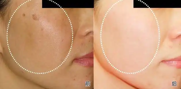 北京美莱医疗美容医院|北京整形医院|北京整形医院排