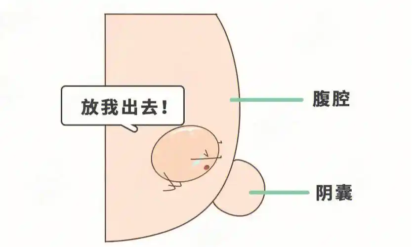 什么是隐睾有什么危害应该什么时候干预