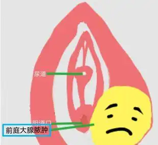 阴道口两侧,其腺体开口位于小阴唇内侧处女膜缘处,主要功能为分泌黏液