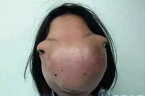 人类史上最怪异的五大畸形人,吓不到你算我输!