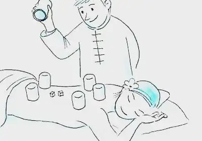 拔火罐疗法,基础认知