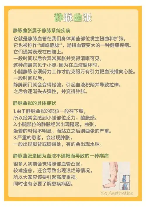 静脉曲张有什么危害静脉曲张怎么调理预防