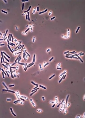 因为芽孢的折光性强,显微镜下它们的亮度很大显微镜下生物膜中的细菌