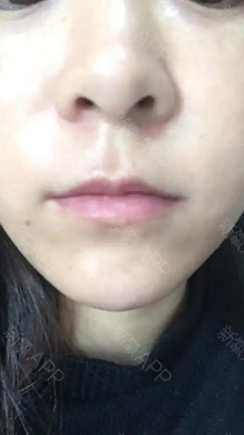 唇线模糊,还稍微有点歪,反正是不好看,五官里面最丑的就是嘴巴了,渴望