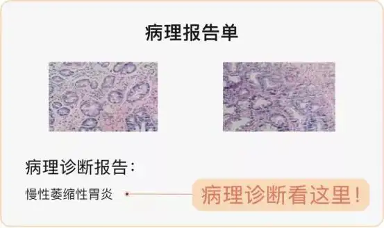 一文说清|看懂胃镜报告!_诊断